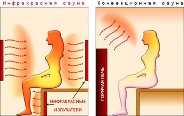 Полезно или вредно для здоровья посещать инфракрасную сауну: лечебные свойства и противопоказания